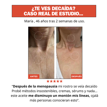 MAGICBODY® | ¡BYE PIEL MADURA!, SIN CLÍNICAS NI AGUJAS